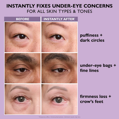 Instant Eye Lift Serum™